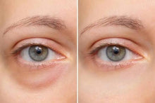 Laden Sie das Bild in den Galerie-Viewer, Eye Conic - der flüssige Beauty Doc